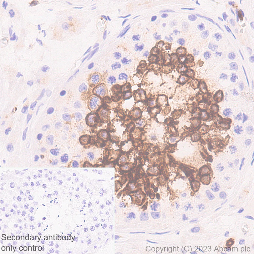 Immunohistochemistry (Formalin/PFA-fixed paraffin-embedded sections) - Anti-Glucose Transporter GLUT3 + GLUT14 antibody [EPR28481-54] (ab315168), expandable thumbnail