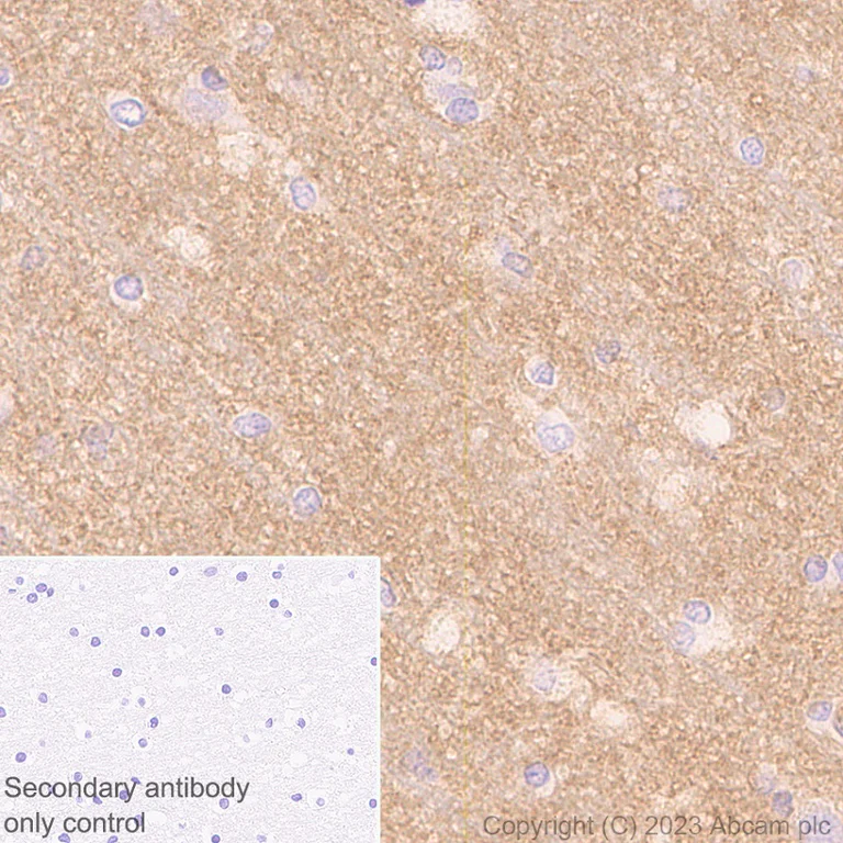 Immunohistochemistry (Formalin/PFA-fixed paraffin-embedded sections) - Anti-Glucose Transporter GLUT3 + GLUT14 antibody [EPR28481-54] (AB315168)