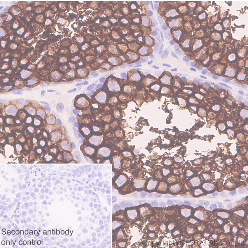 Immunohistochemistry (Formalin/PFA-fixed paraffin-embedded sections) - Anti-Glucose Transporter GLUT3 + GLUT14 antibody [EPR28481-54] (ab315168), expandable thumbnail