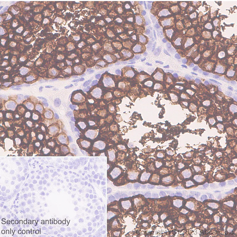 Immunohistochemistry (Formalin/PFA-fixed paraffin-embedded sections) - Anti-Glucose Transporter GLUT3 + GLUT14 antibody [EPR28481-54] (AB315168)