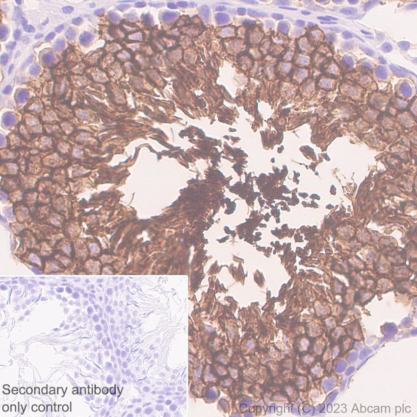 Immunohistochemistry (Formalin/PFA-fixed paraffin-embedded sections) - Anti-Glucose Transporter GLUT3 + GLUT14 antibody [EPR28481-54] (ab315168), expandable thumbnail