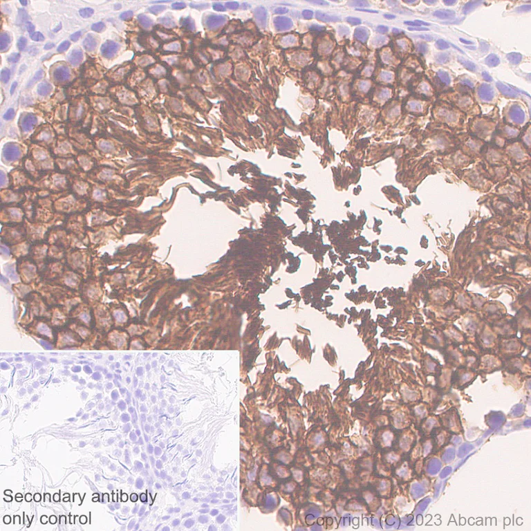 Immunohistochemistry (Formalin/PFA-fixed paraffin-embedded sections) - Anti-Glucose Transporter GLUT3 + GLUT14 antibody [EPR28481-54] (AB315168)
