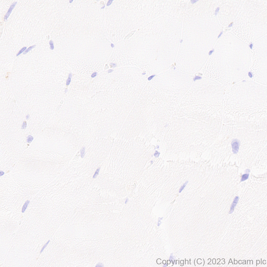 Immunohistochemistry (Formalin/PFA-fixed paraffin-embedded sections) - Anti-Glucose Transporter GLUT3 + GLUT14 antibody [EPR28481-54] (AB315168), expandable thumbnail