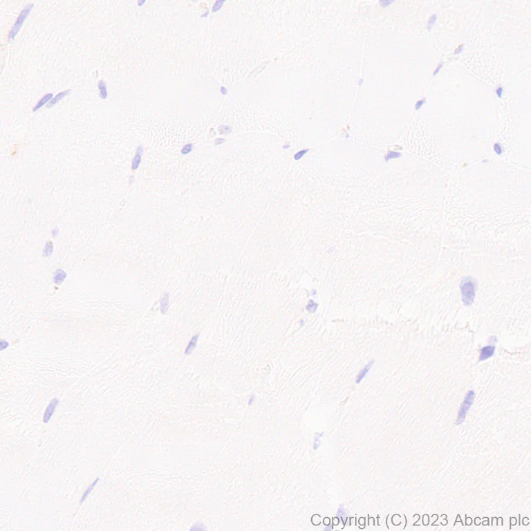 Immunohistochemistry (Formalin/PFA-fixed paraffin-embedded sections) - Anti-Glucose Transporter GLUT3 + GLUT14 antibody [EPR28481-54] (AB315168)