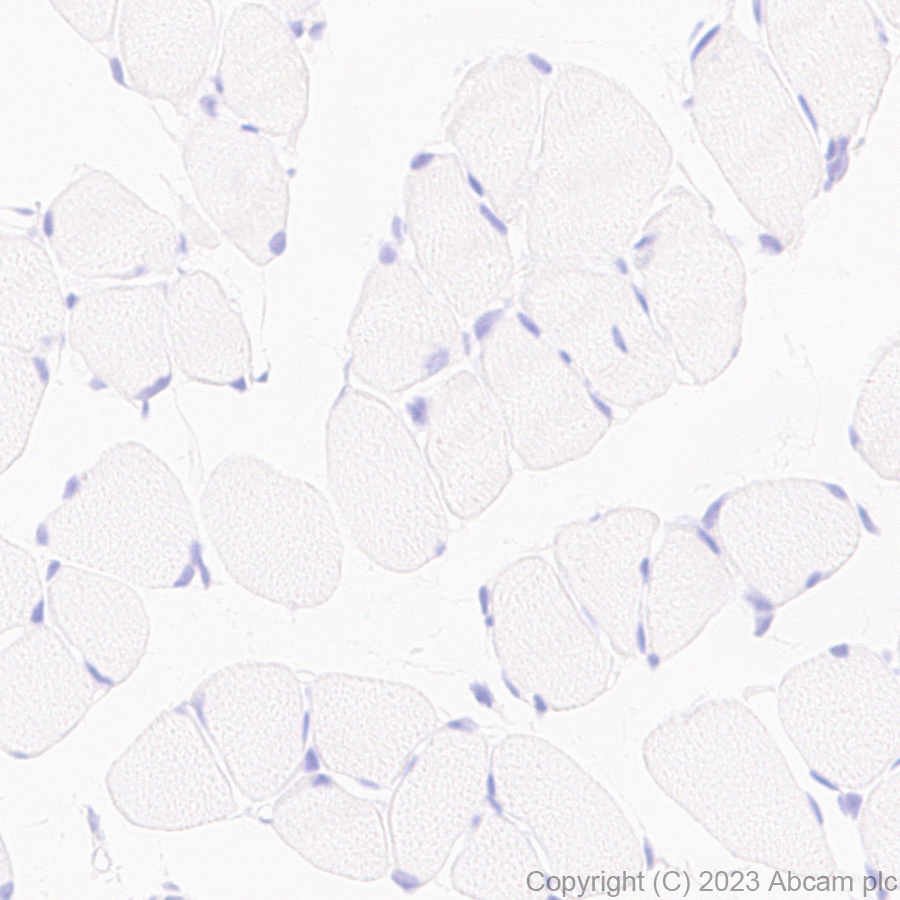 Immunohistochemistry (Formalin/PFA-fixed paraffin-embedded sections) - Anti-Glucose Transporter GLUT3 + GLUT14 antibody [EPR28481-54] (ab315168), expandable thumbnail