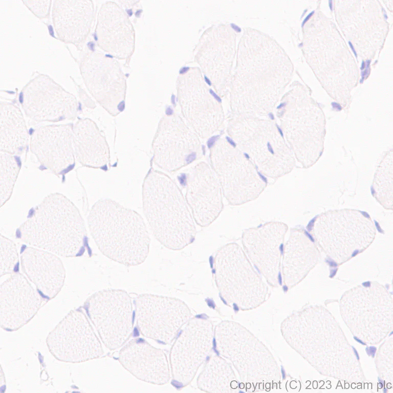 Immunohistochemistry (Formalin/PFA-fixed paraffin-embedded sections) - Anti-Glucose Transporter GLUT3 + GLUT14 antibody [EPR28481-54] (AB315168)