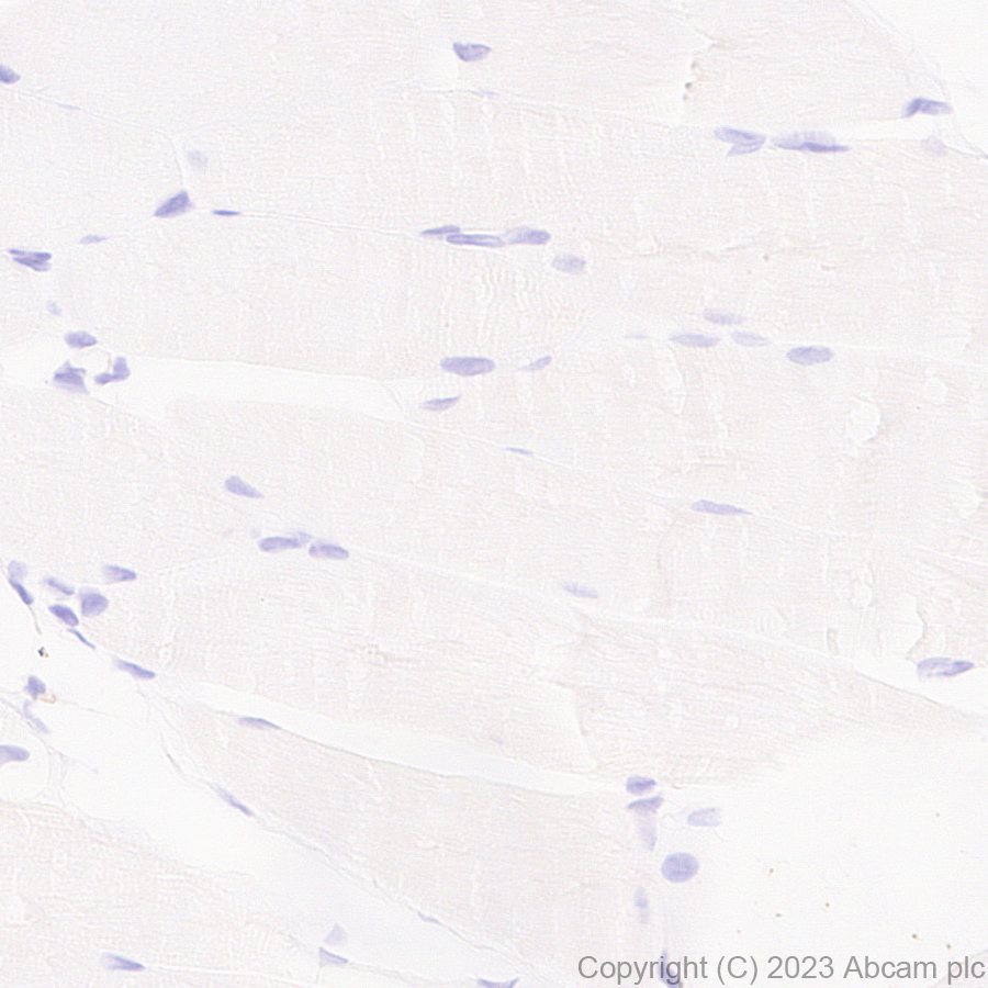 Immunohistochemistry (Formalin/PFA-fixed paraffin-embedded sections) - Anti-Glucose Transporter GLUT3 + GLUT14 antibody [EPR28481-54] (ab315168), expandable thumbnail
