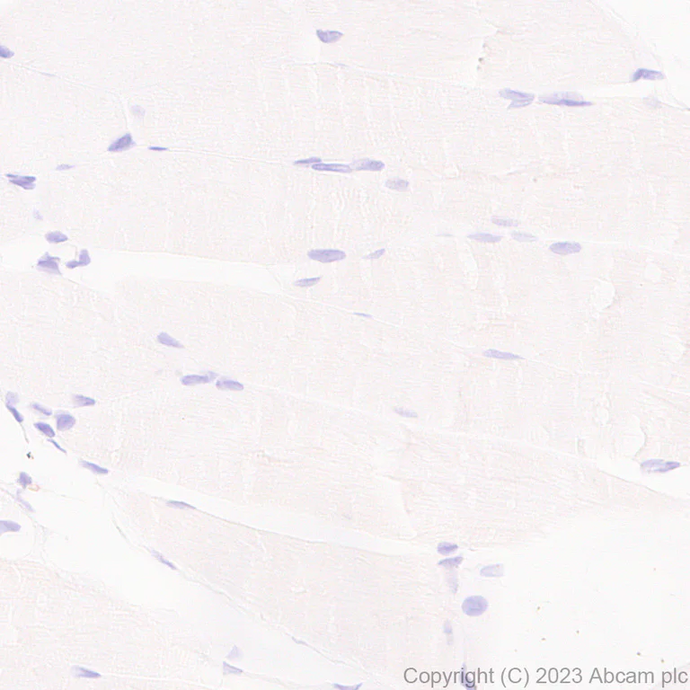 Immunohistochemistry (Formalin/PFA-fixed paraffin-embedded sections) - Anti-Glucose Transporter GLUT3 + GLUT14 antibody [EPR28481-54] (AB315168)