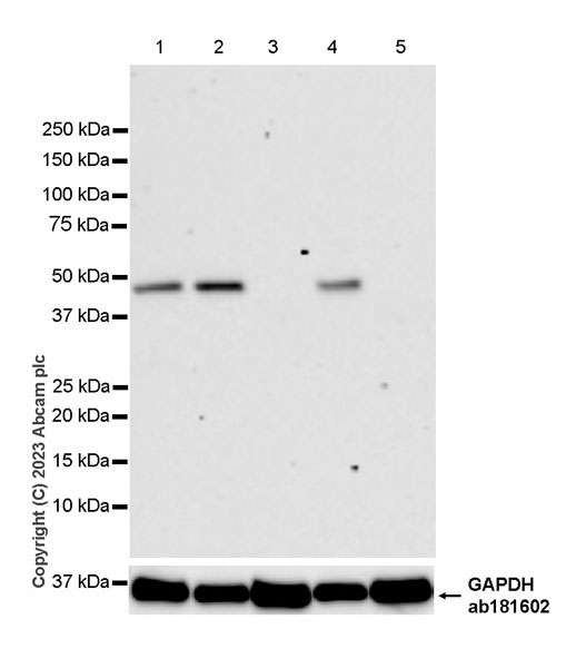Western blot - Anti-Glucose Transporter GLUT3 + GLUT14 antibody [EPR28481-54] (ab315168), expandable thumbnail