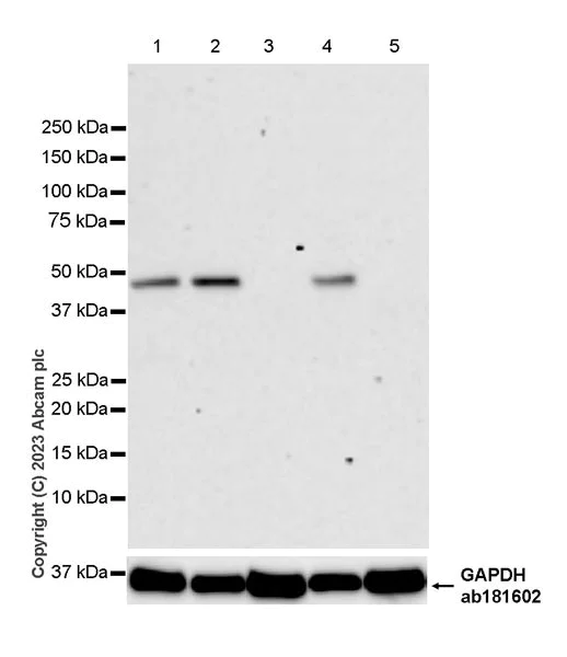 Western blot - Anti-Glucose Transporter GLUT3 + GLUT14 antibody [EPR28481-54] (AB315168)