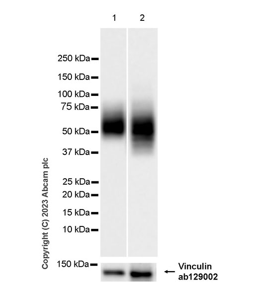 Western blot - Anti-Glucose Transporter GLUT3 + GLUT14 antibody [EPR28481-54] (AB315168), expandable thumbnail