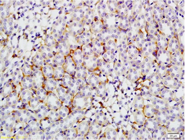 Immunohistochemistry (Formalin/PFA-fixed paraffin-embedded sections) - Anti-Glucose Transporter GLUT4 antibody (AB216661)