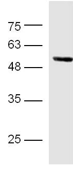 Western blot - Anti-Glucose Transporter GLUT4 antibody (AB216661)