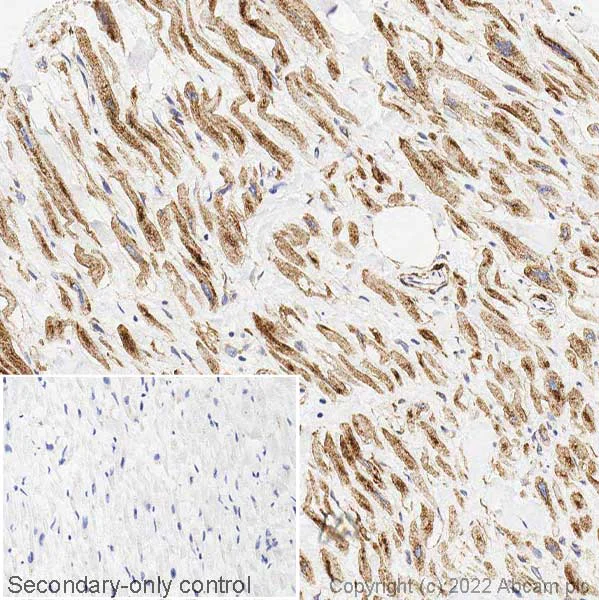 Immunohistochemistry (Formalin/PFA-fixed paraffin-embedded sections) - Anti-Glucose Transporter GLUT4 antibody (AB33780)