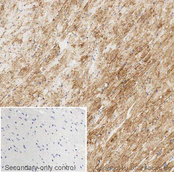Immunohistochemistry (Formalin/PFA-fixed paraffin-embedded sections) - Anti-Glucose Transporter GLUT4 antibody (AB33780)