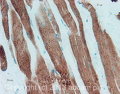 Immunohistochemistry (Formalin/PFA-fixed paraffin-embedded sections) - Anti-Glucose Transporter GLUT4 antibody (AB33780)