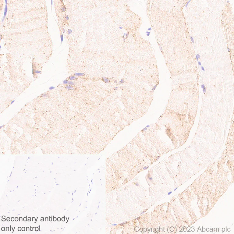 Immunohistochemistry (Formalin/PFA-fixed paraffin-embedded sections) - Anti-Glucose Transporter GLUT4 antibody [EPR26571-45] (AB313775)