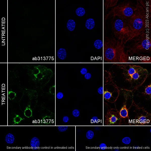 Immunocytochemistry/ Immunofluorescence - Anti-Glucose Transporter GLUT4 antibody [EPR26571-45] - BSA and Azide free (AB313776)