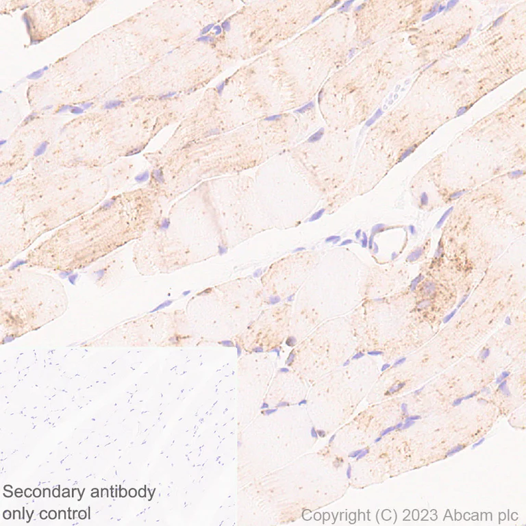 Immunohistochemistry (Formalin/PFA-fixed paraffin-embedded sections) - Anti-Glucose Transporter GLUT4 antibody [EPR26571-45] - BSA and Azide free (AB313776)