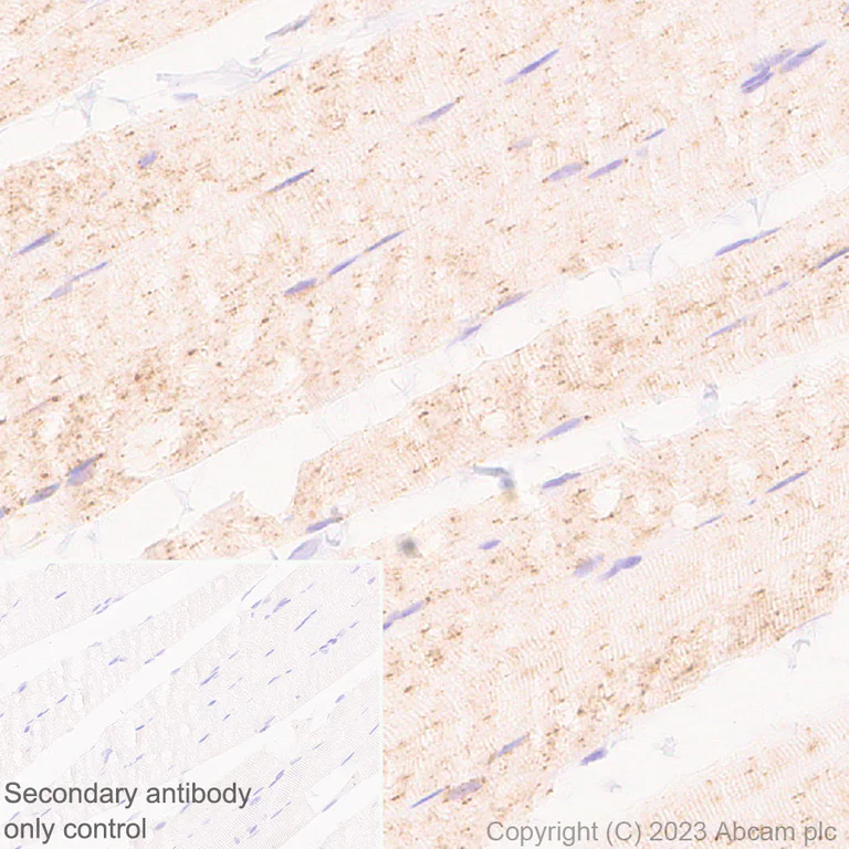 Immunohistochemistry (Formalin/PFA-fixed paraffin-embedded sections) - Anti-Glucose Transporter GLUT4 antibody [EPR26571-45] - BSA and Azide free (AB313776)