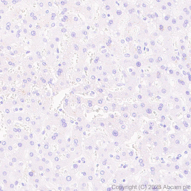 Immunohistochemistry (Formalin/PFA-fixed paraffin-embedded sections) - Anti-Glucose Transporter GLUT4 antibody [EPR26571-45] - BSA and Azide free (AB313776)