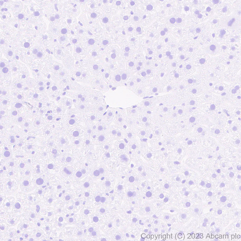Immunohistochemistry (Formalin/PFA-fixed paraffin-embedded sections) - Anti-Glucose Transporter GLUT4 antibody [EPR26571-45] - BSA and Azide free (AB313776)