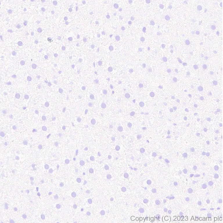 Immunohistochemistry (Formalin/PFA-fixed paraffin-embedded sections) - Anti-Glucose Transporter GLUT4 antibody [EPR26571-45] - BSA and Azide free (AB313776)