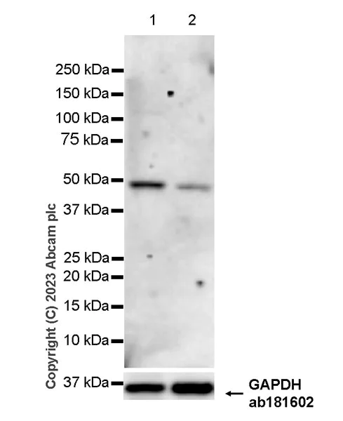 Western blot - Anti-Glucose Transporter GLUT4 antibody [EPR26571-45] - BSA and Azide free (AB313776)