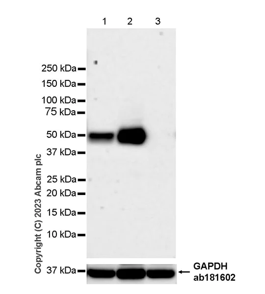 Western blot - Anti-Glucose Transporter GLUT4 antibody [EPR26571-45] - BSA and Azide free (AB313776)
