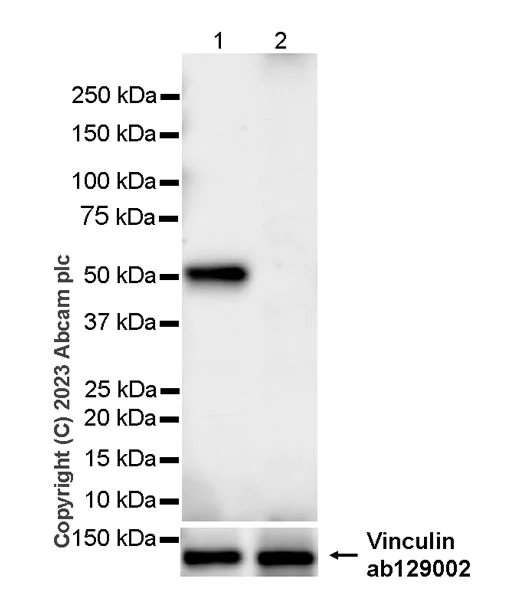 Western blot - Anti-Glucose Transporter GLUT4 antibody [EPR26571-45] - BSA and Azide free (AB313776)