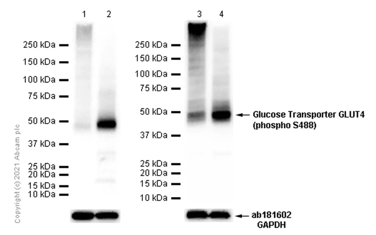 Western blot - Anti-Glucose Transporter GLUT4 (phospho S488) antibody [EPR930(2)] (AB188317)