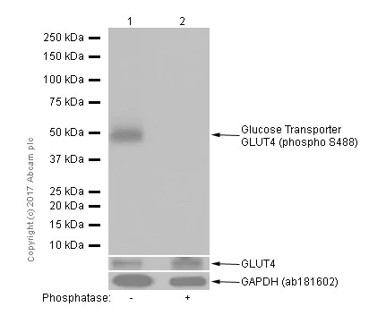 Western blot - Anti-Glucose Transporter GLUT4 (phospho S488) antibody [EPR930(2)] - BSA and Azide free (AB250949)