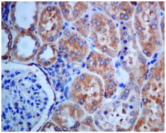 Immunohistochemistry (Formalin/PFA-fixed paraffin-embedded sections) - Anti-Glucosidase 2 subunit beta antibody [EPR8046] - BSA and Azide free (AB248669), expandable thumbnail