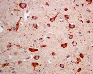 Immunohistochemistry (Formalin/PFA-fixed paraffin-embedded sections) - Anti-Glucosidase 2 subunit beta antibody [EPR8047] (AB129098)