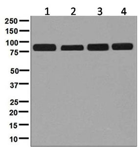 Western blot - Anti-Glucosidase 2 subunit beta antibody [EPR8047] (AB129098), expandable thumbnail