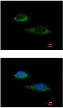 Immunocytochemistry/ Immunofluorescence - Anti-GLUD1 antibody (AB153973), expandable thumbnail