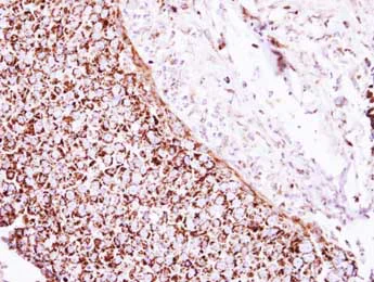 Immunohistochemistry (Formalin/PFA-fixed paraffin-embedded sections) - Anti-GLUD1 antibody (AB153973)