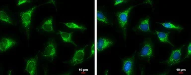 Immunocytochemistry/ Immunofluorescence - Anti-GLUD1 + GLUD2 antibody (AB154027)