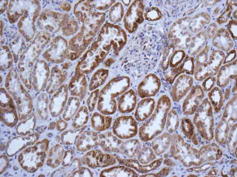 Immunohistochemistry (Formalin/PFA-fixed paraffin-embedded sections) - Anti-GLUD1 + GLUD2 antibody [EPR11369(B)] (AB166618)
