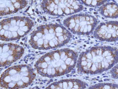 Immunohistochemistry (Formalin/PFA-fixed paraffin-embedded sections) - Anti-GLUD1 + GLUD2 antibody [EPR11369(B)] (AB166618)
