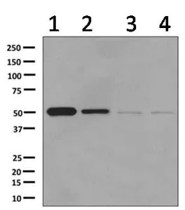 Western blot - Anti-GLUD1 + GLUD2 antibody [EPR11369(B)] (AB166618)