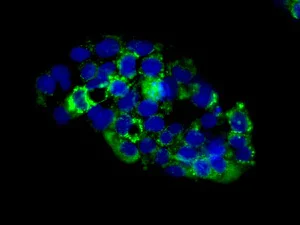 Immunocytochemistry/ Immunofluorescence - Anti-GLUD1 + GLUD2 antibody [EPR11370] (AB168352)