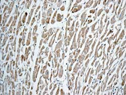 Immunohistochemistry (Formalin/PFA-fixed paraffin-embedded sections) - Anti-GLUD1 + GLUD2 antibody [EPR11370] (ab168352), expandable thumbnail