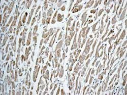 Immunohistochemistry (Formalin/PFA-fixed paraffin-embedded sections) - Anti-GLUD1 + GLUD2 antibody [EPR11370] (AB168352)