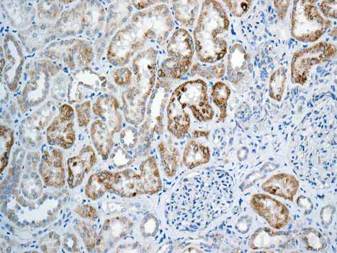 Immunohistochemistry (Formalin/PFA-fixed paraffin-embedded sections) - Anti-GLUD1 + GLUD2 antibody [EPR11370] (ab168352), expandable thumbnail