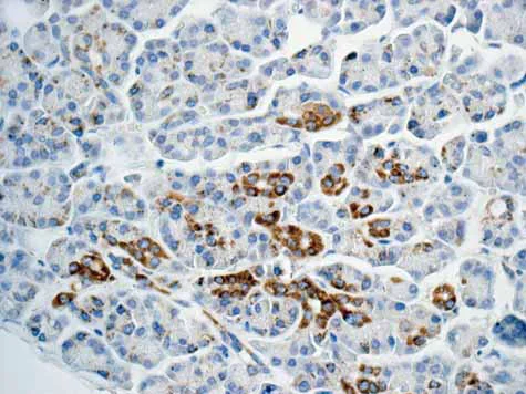Immunohistochemistry (Formalin/PFA-fixed paraffin-embedded sections) - Anti-GLUD1 + GLUD2 antibody [EPR11370] (AB168352)