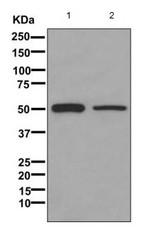 Western blot - Anti-GLUD1 + GLUD2 antibody [EPR11370] (AB168352), expandable thumbnail