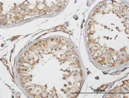 Immunohistochemistry (Formalin/PFA-fixed paraffin-embedded sections) - Anti-GLUD2 antibody (AB88519)