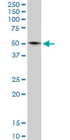Western blot - Anti-GLUD2 antibody (AB88519)