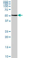 Western blot - Anti-GLUD2 antibody (AB88519)